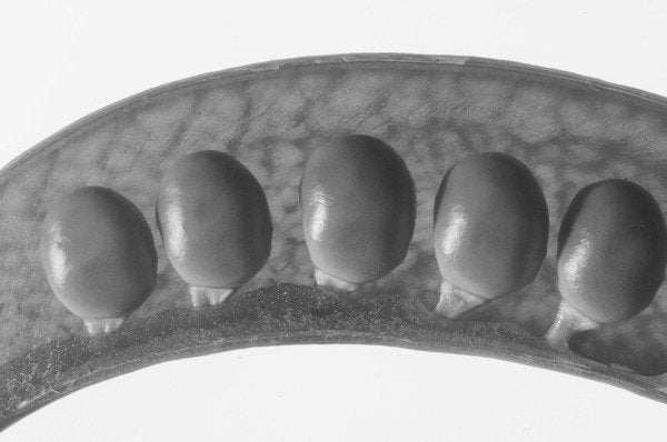 Detail of Peas, 2009 by Anonymous