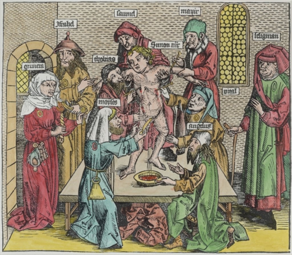 Detail of Circumcision by German School