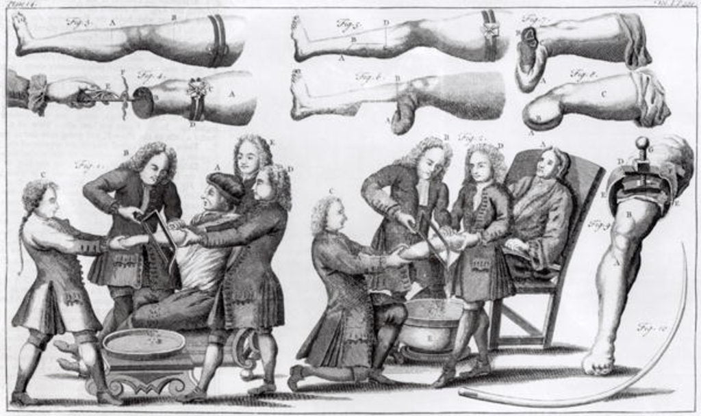 Detail of Surgical operations on limbs by English School