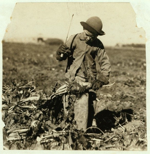 Detail of Alex Reiber aged 7 carries on topping sugar beets after 'hooking' his knee, near Sterling, Colorado, 1915 by Lewis Wickes Hine
