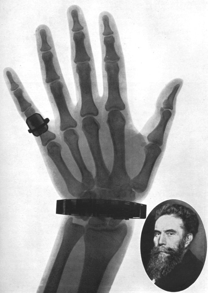 Detail of X-ray photograph of a hand by Anonymous