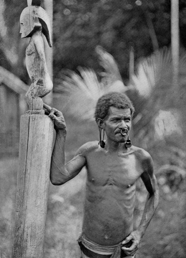 Detail of Malformation of the ears, Solomon Islands by JW Beattie