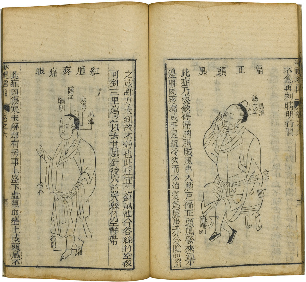 Detail of Shen Shi Yao Han (A Precious Book of Ophthalmology), 1644 by Fu Renyu