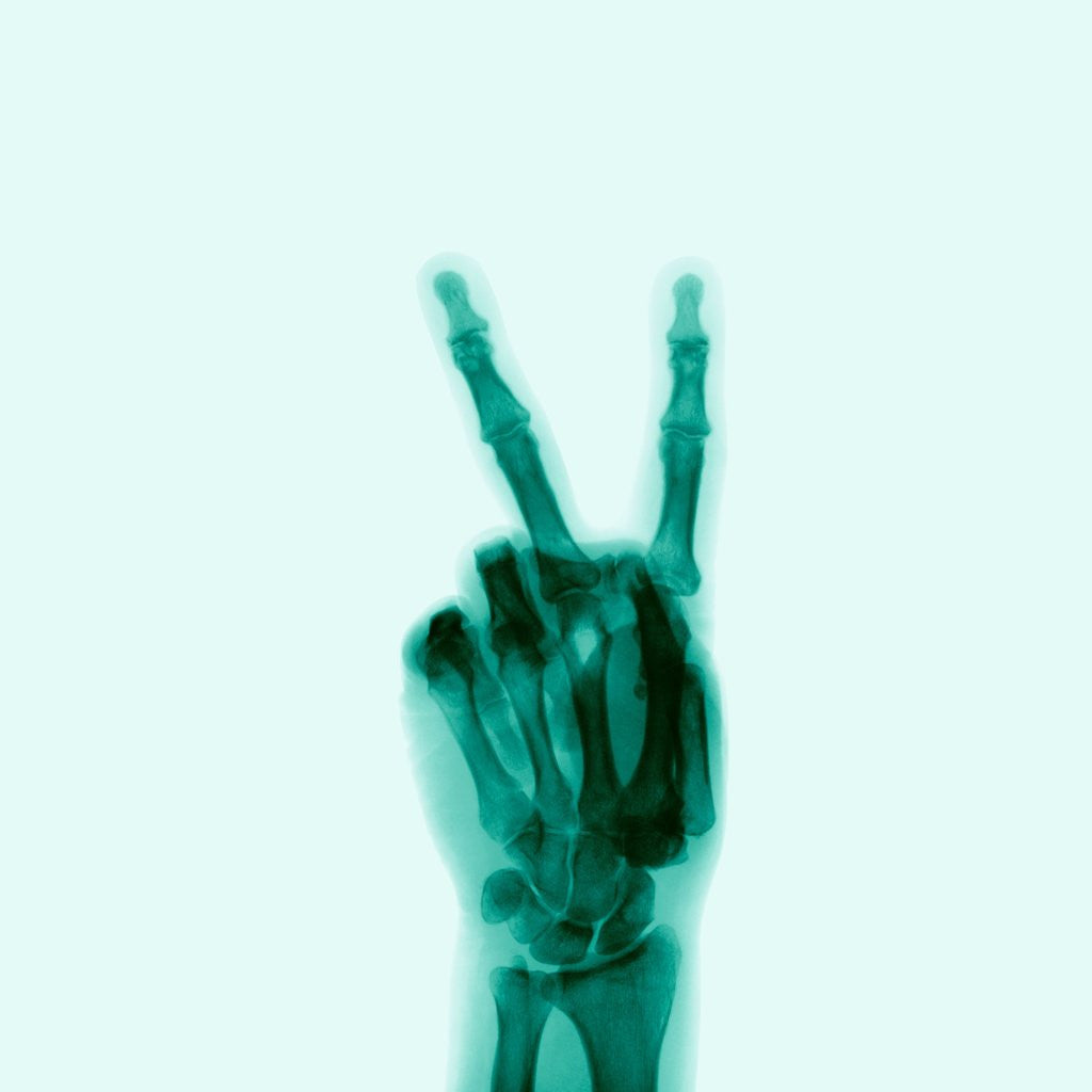 Detail of X-Ray of Hand Doing Peace Sign by Anonymous