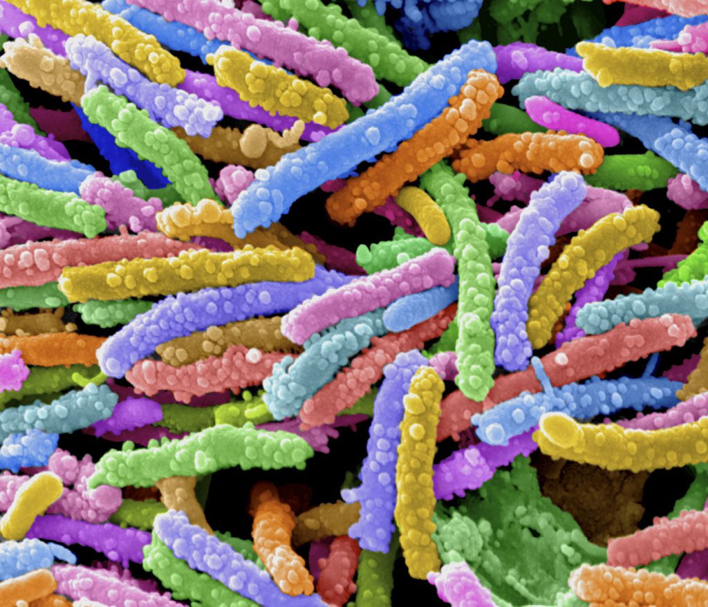 Detail of E. Coli Bacteria by Corbis