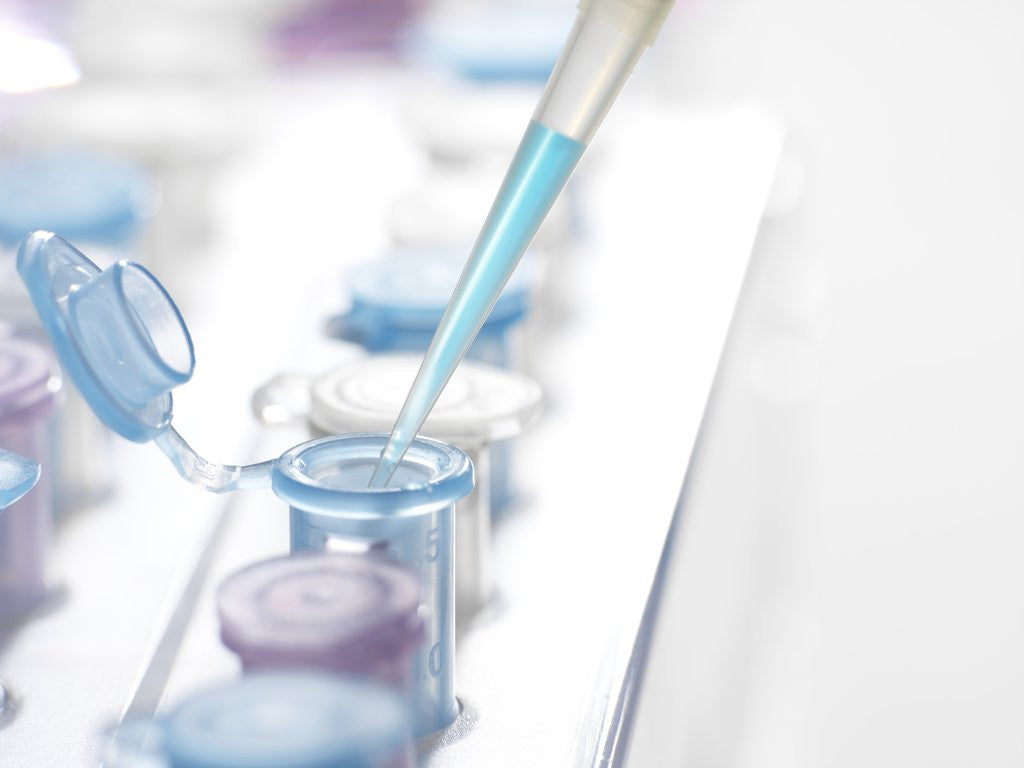 Detail of DNA Testing by Anonymous