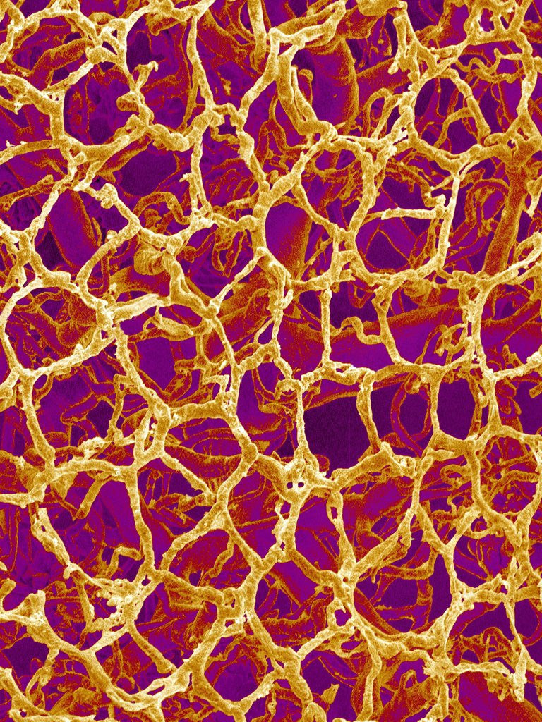 Detail of Blood Vessel Cast from Colon of a Rat by Anonymous