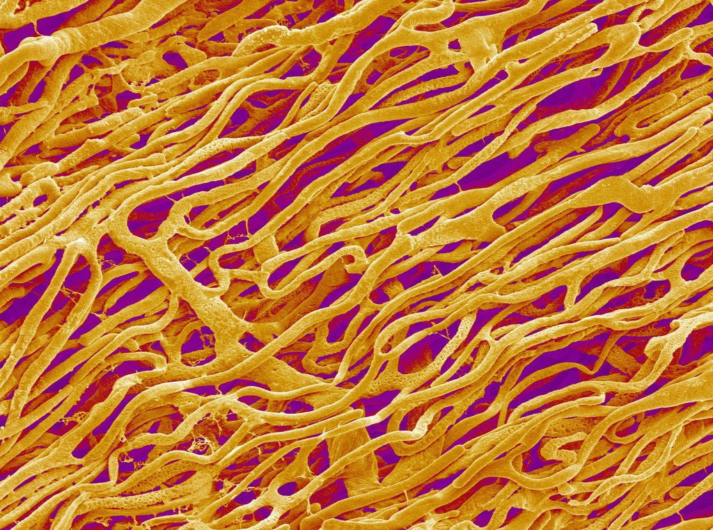 Detail of Blood Vessel Cast in Heart of a Rat by Anonymous