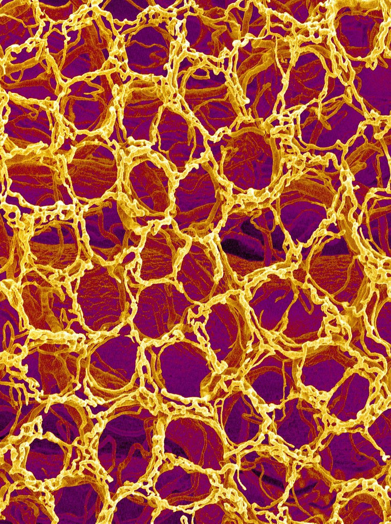 Detail of Blood Vessel Cast from Stomach of a Rat by Anonymous