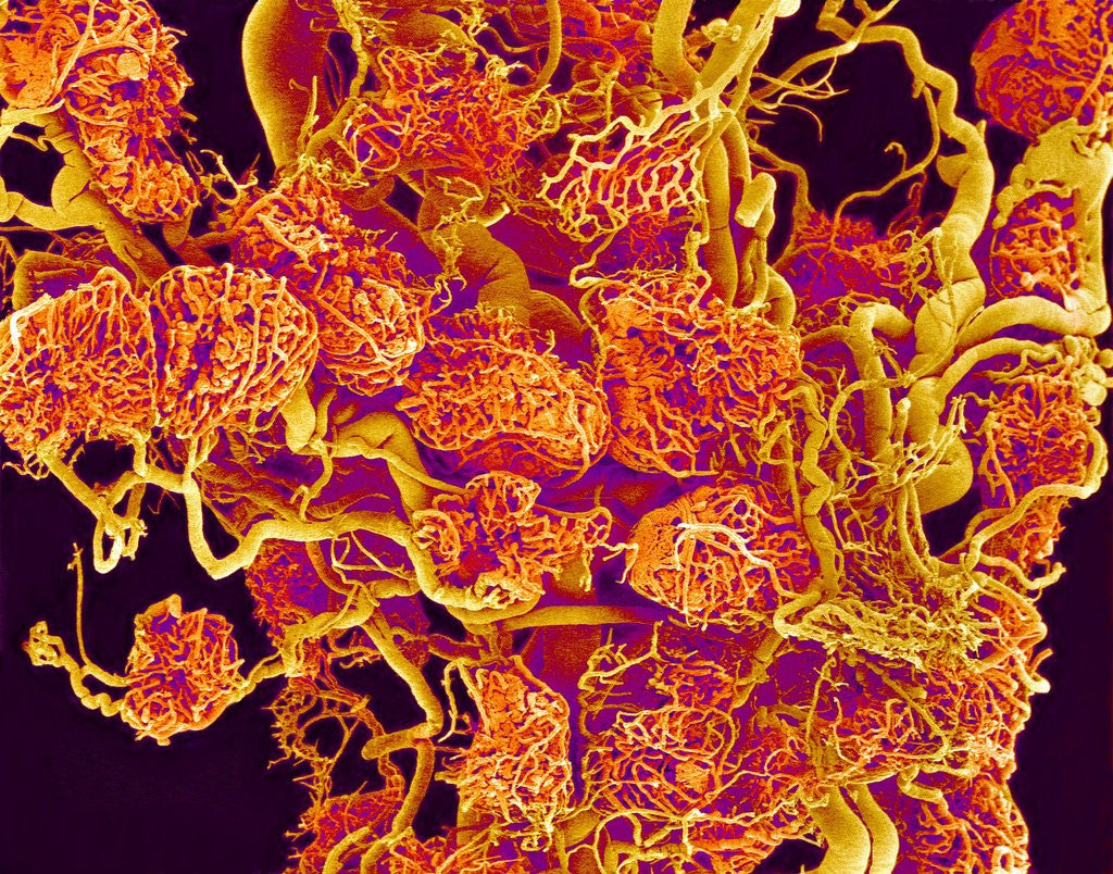 Detail of Blood Vessels and Corpus Luteum in Ovary of a Frog by Anonymous