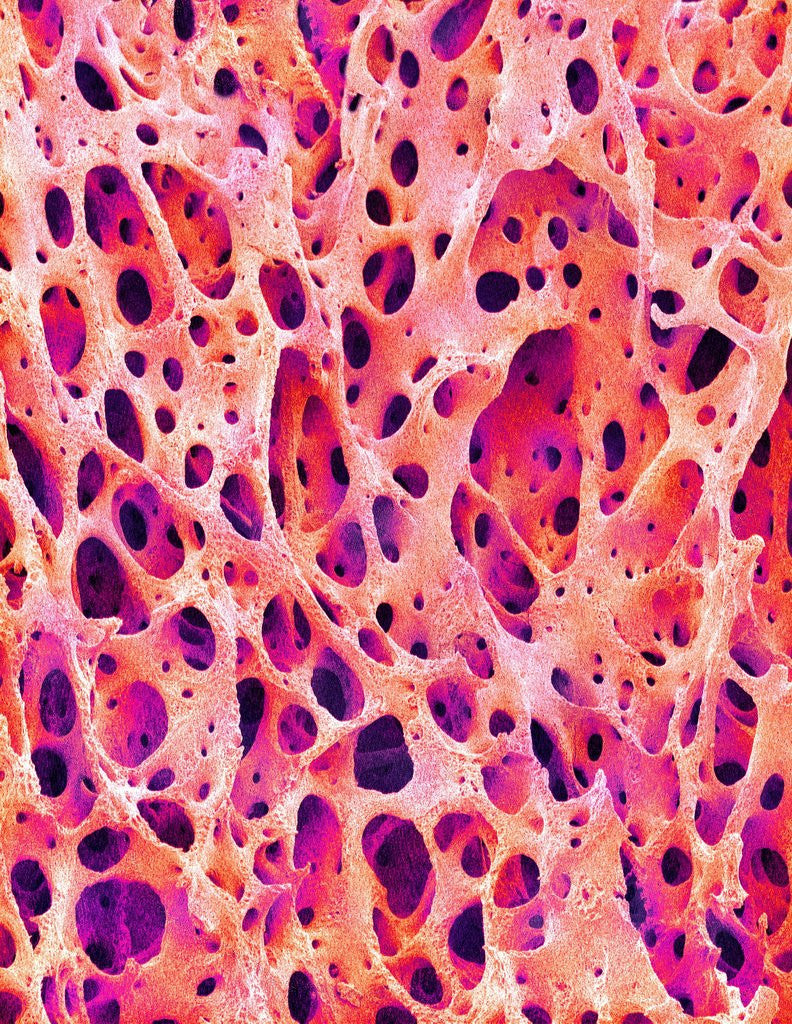 Detail of Bone Tissue of Chicken by Corbis