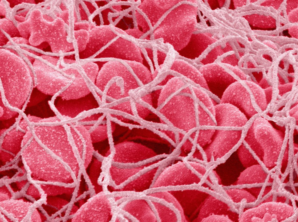 Detail of Coagulated Red Blood Cells by Anonymous