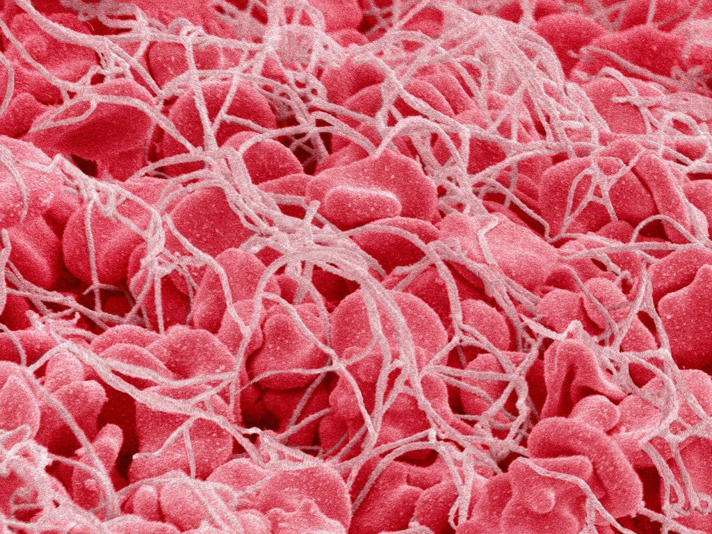 Detail of Coagulated Human Red Blood Cells by Anonymous