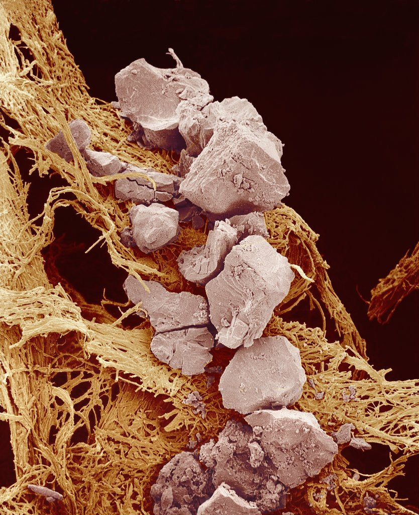 Detail of Eggshell by Anonymous