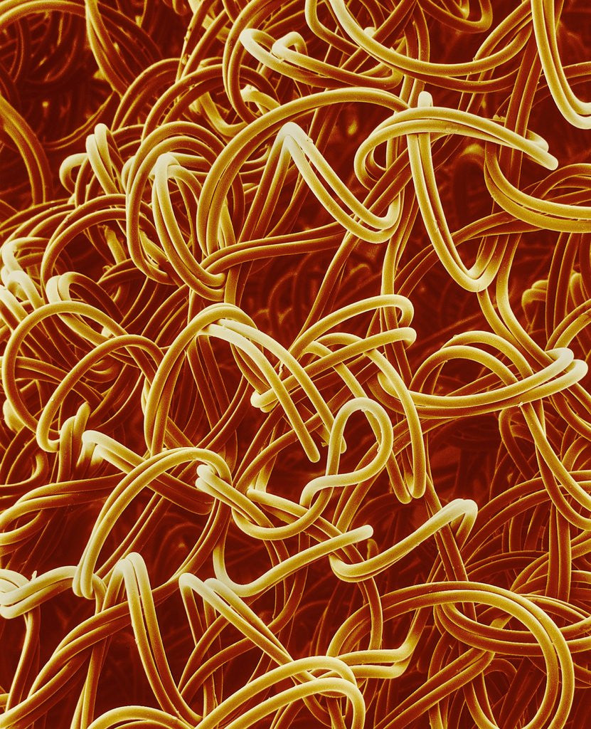 Detail of Panty Hose by Anonymous