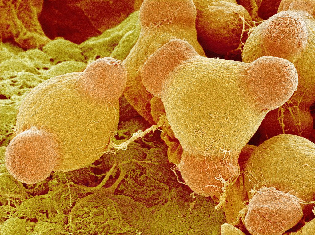Detail of Pollen of Evening Primrose by Anonymous