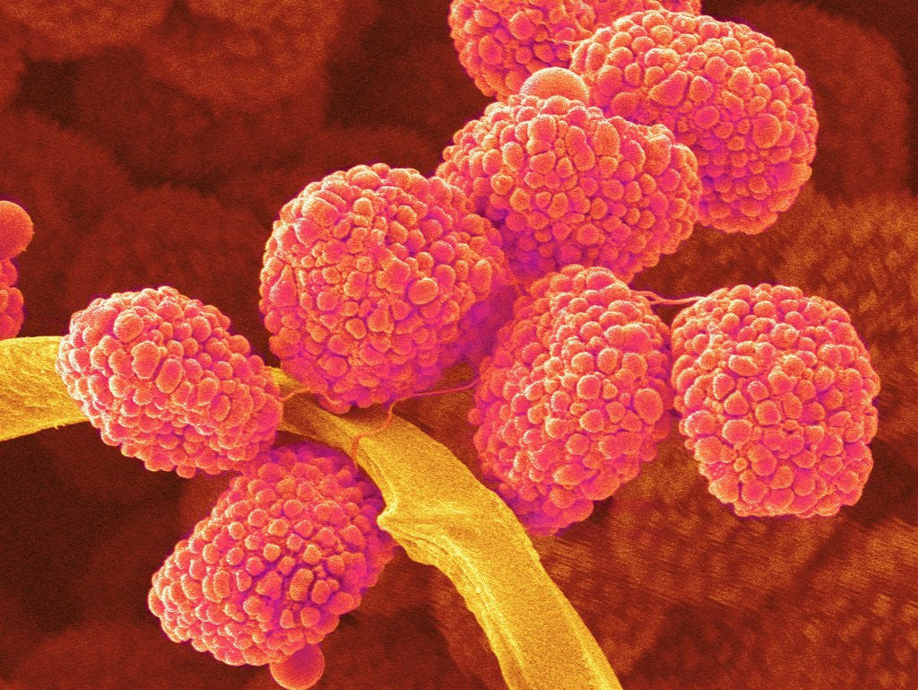 Detail of Moss Spores by Anonymous
