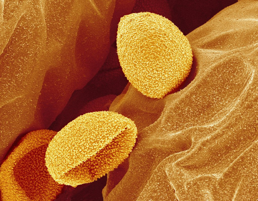Detail of Spores of a Flowering Fern by Anonymous