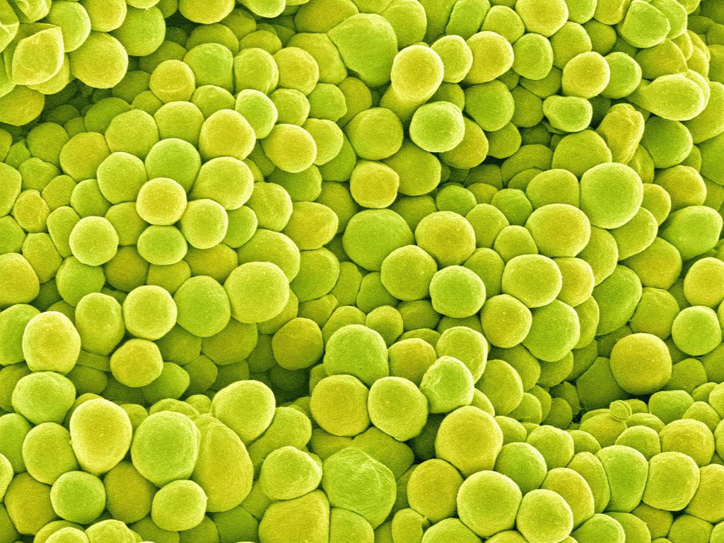 Detail of Pistil of Buttercup by Anonymous