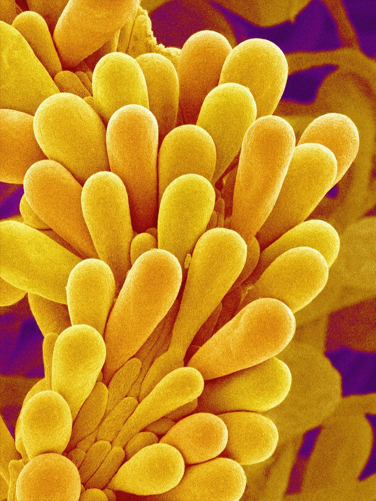 Detail of Pistil of Wildflower of Genus Rubia by Anonymous