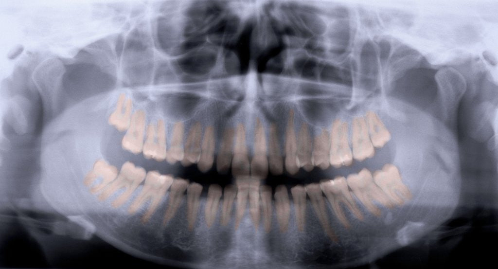Detail of Panoramic X-Ray of Mouth by Anonymous