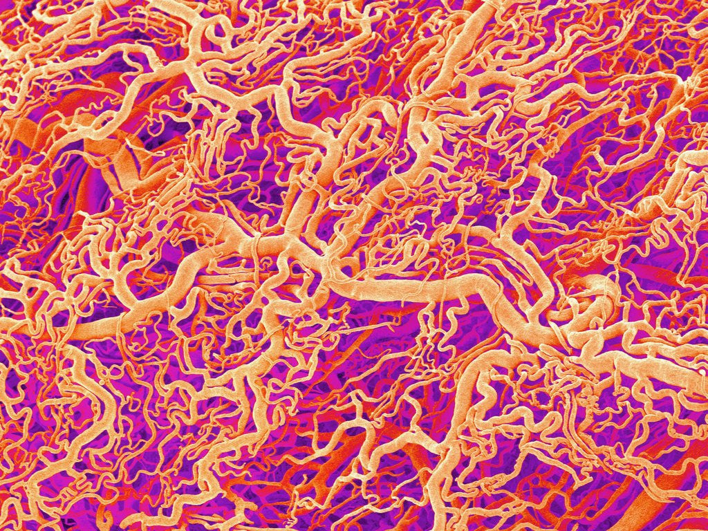 Detail of Blood Vessel Cast of Connective Tissue of a Rat by Anonymous
