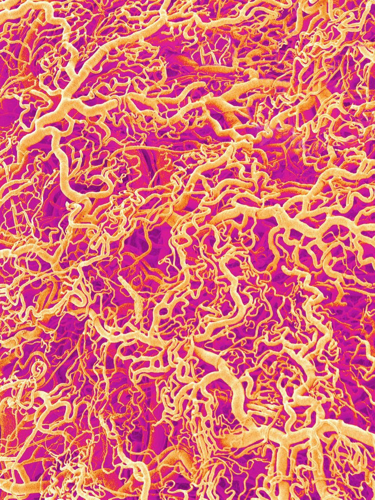 Detail of Blood Vessel Cast of Connective Tissue of a Rat by Corbis