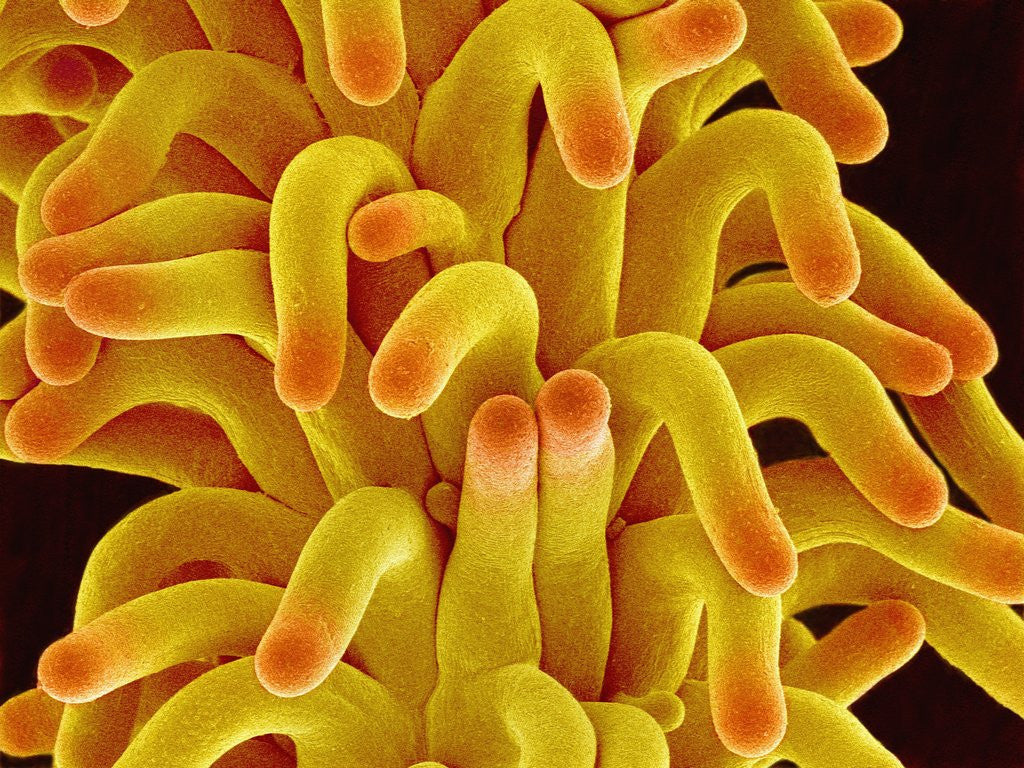 Detail of Pistil of a Chickweed Plant by Anonymous