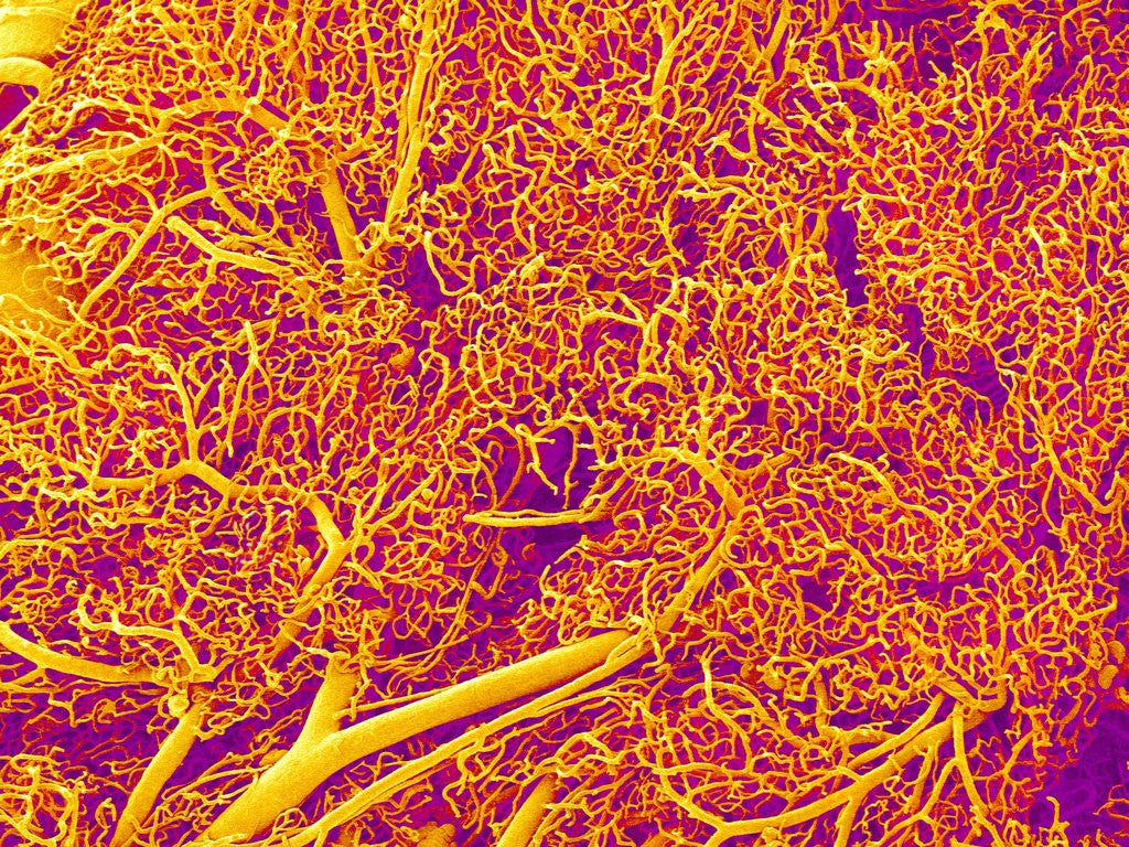 Detail of Blood Vessel Cast from Rat Pancreas by Anonymous
