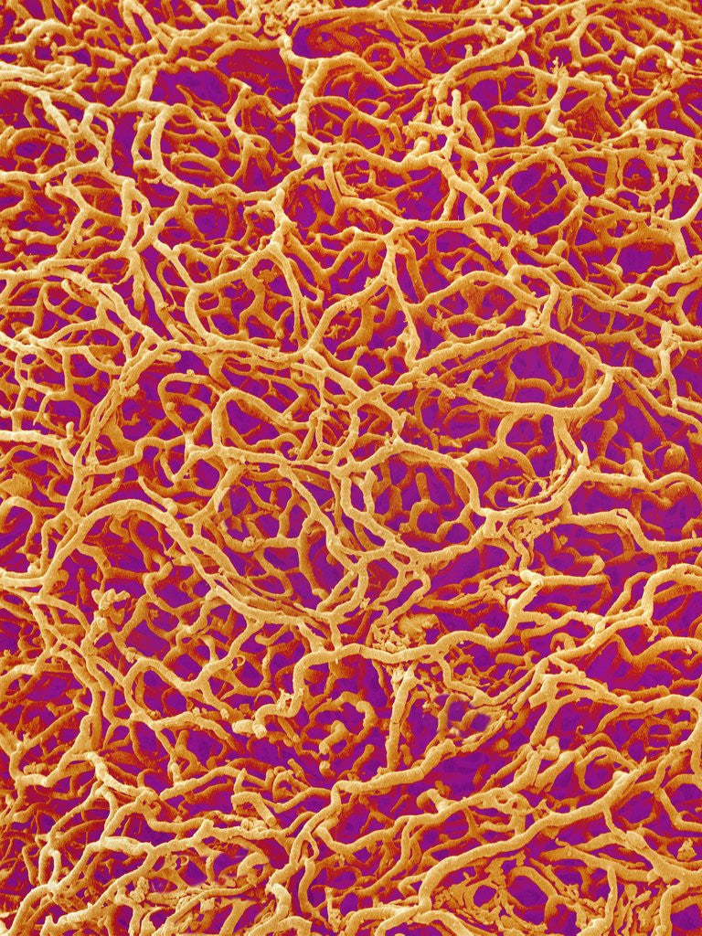 Detail of Blood Vessel Cast from Rat Colon by Anonymous