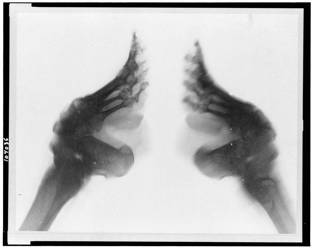 Detail of X-Ray of Bound Feet by Anonymous