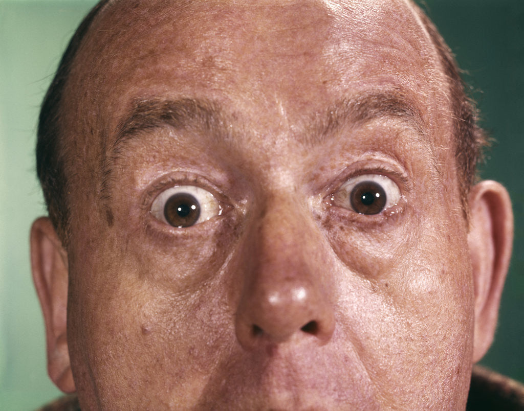 Detail of 1960s Close-Up Detail Of Florid Man Face With Eyes Open Wide And Staring by Corbis