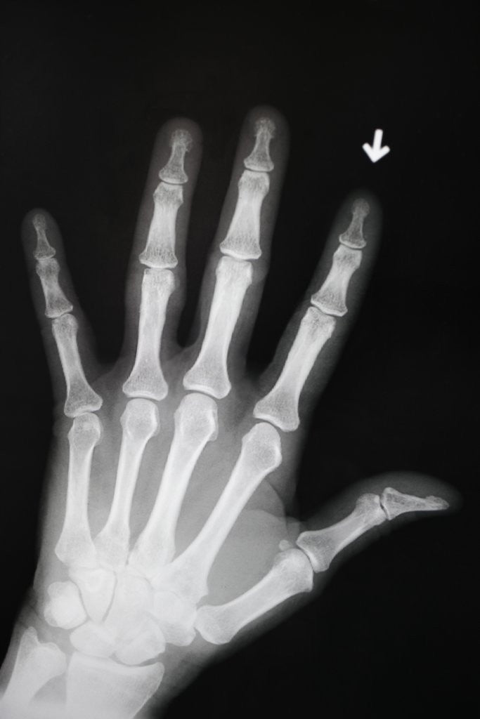 Detail of Hand Bones by Anonymous