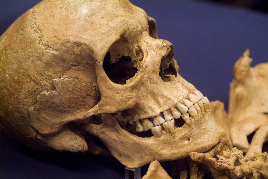 Detail of Skull of Early Settler by Corbis
