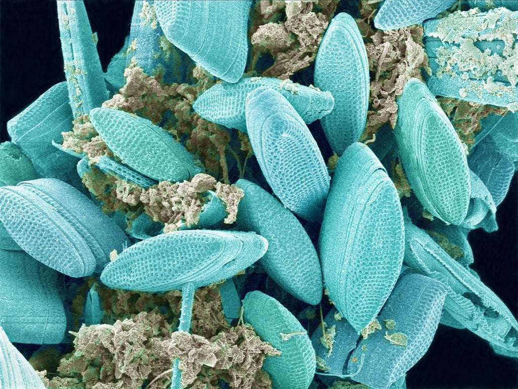 Detail of Marine Diatom by Anonymous