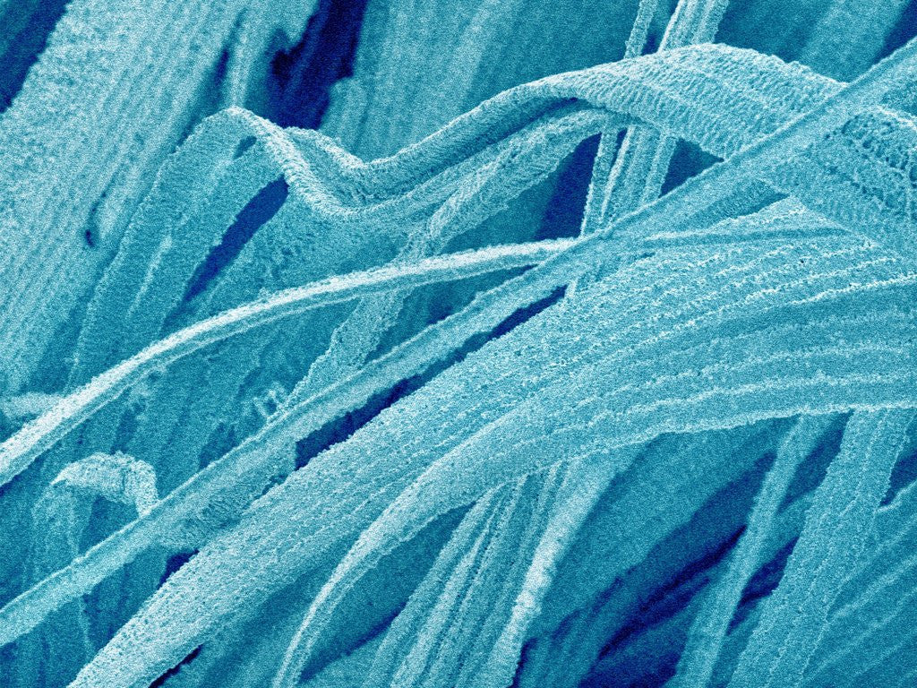 Detail of Lens fiber of a rabbit eye by Anonymous