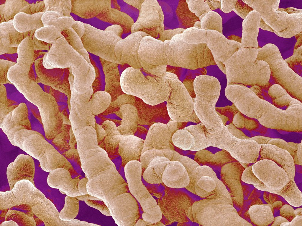 Detail of Human Placenta by Anonymous
