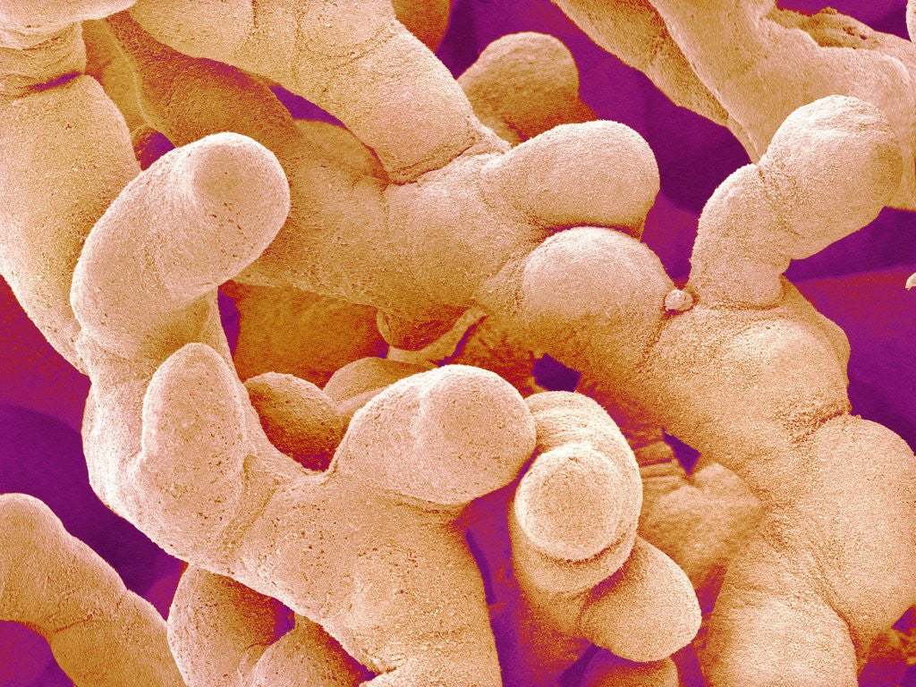 Detail of Human Placenta by Anonymous