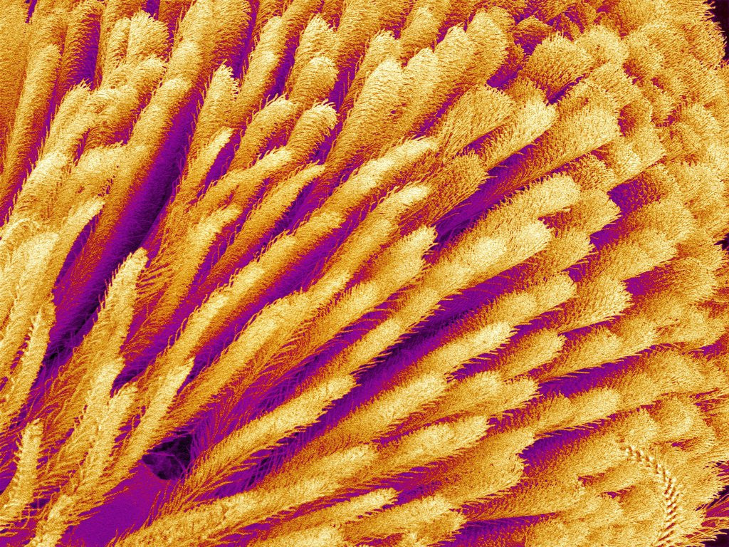 Detail of Hairs on the tip of the leg of a spider by Corbis