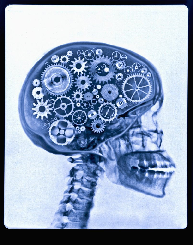 Detail of X-ray of skull with gears by Corbis