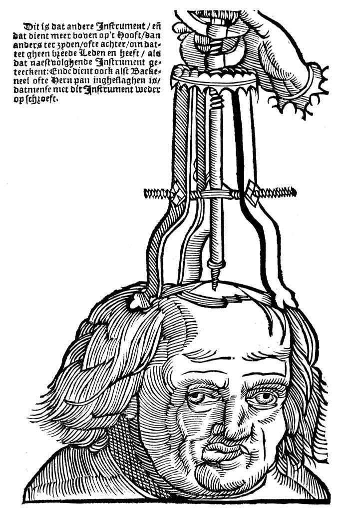 Detail of Trepanation by Anonymous