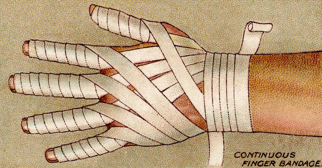 Detail of Bandaged hand by Anonymous