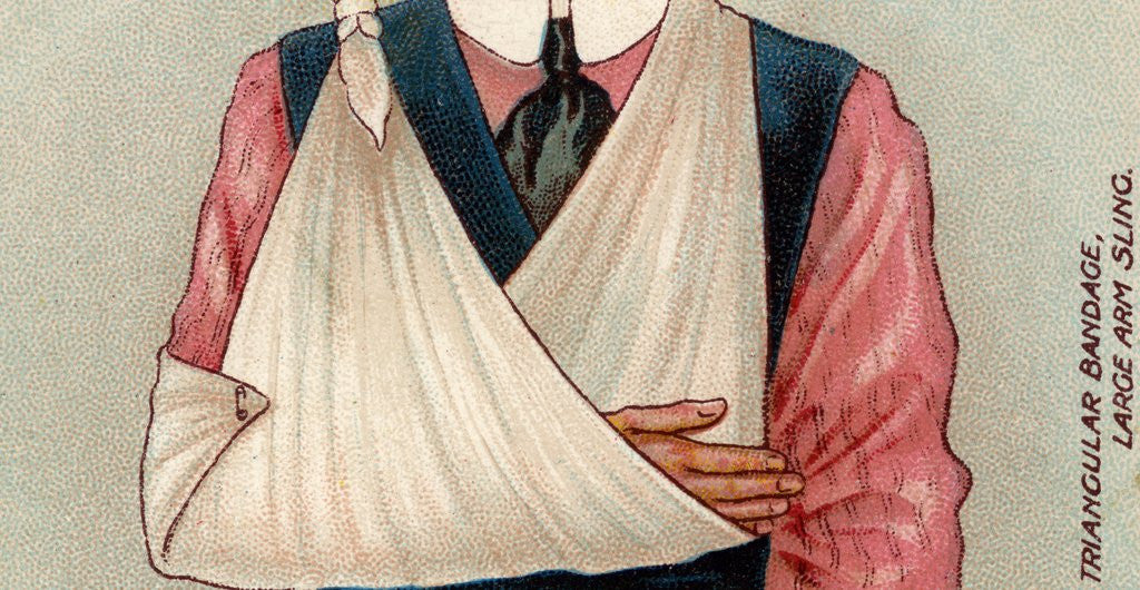 Detail of Arm in sling by Anonymous