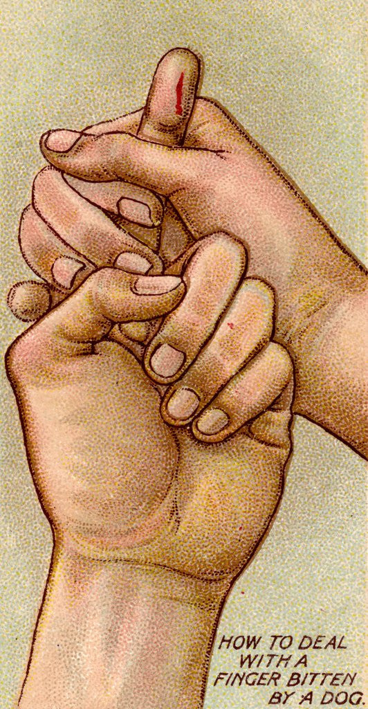 Detail of Bleeding finger by Anonymous