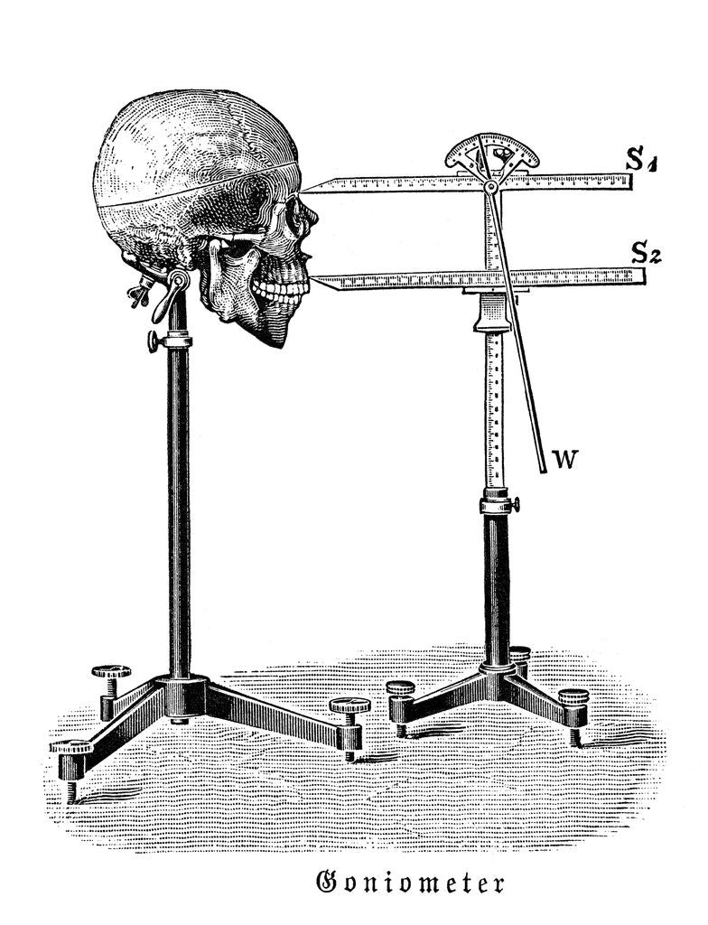 Detail of Goniometer measuring human skull by Anonymous