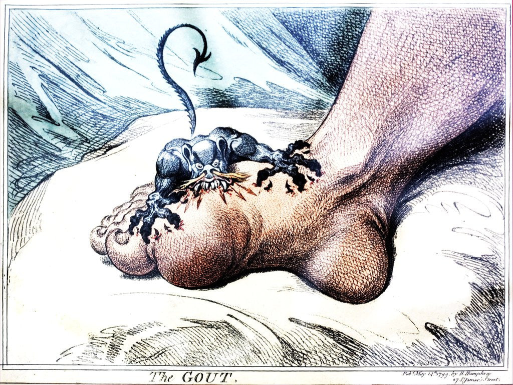 Detail of The Gout by Anonymous