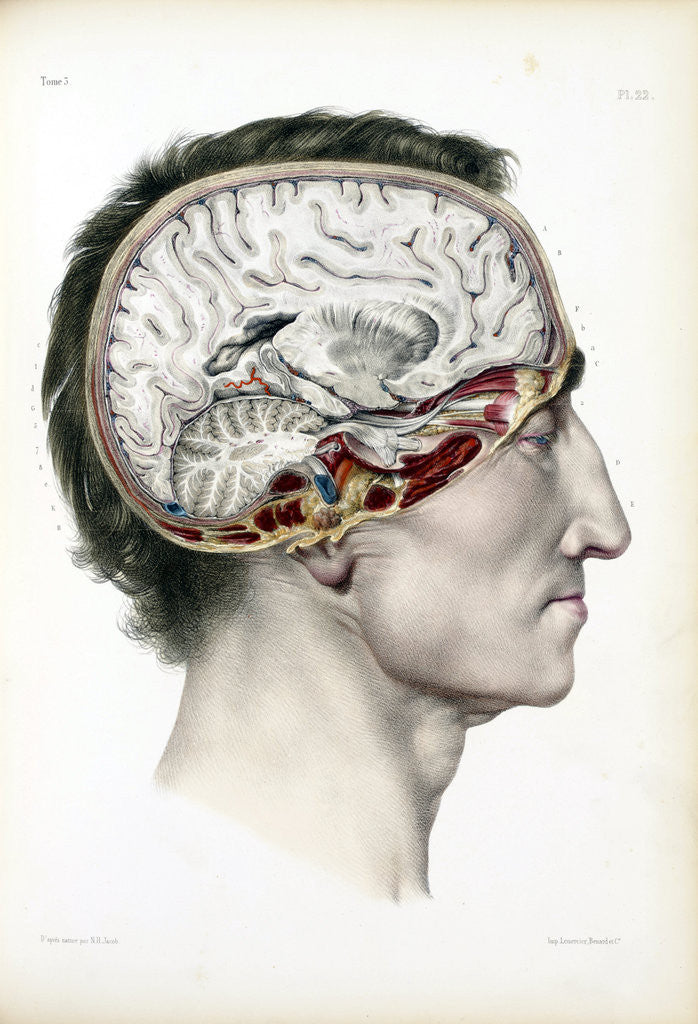 Detail of Dissected head in profile showing the brain by Anonymous