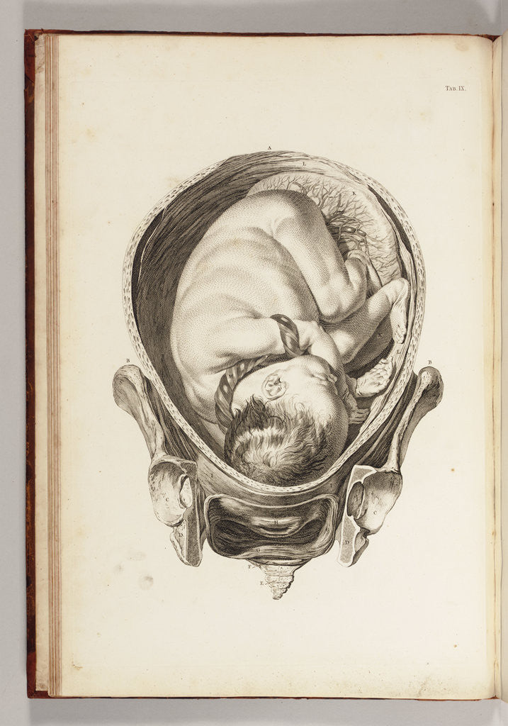 Detail of Engraving of a child in the womb by William Smellie