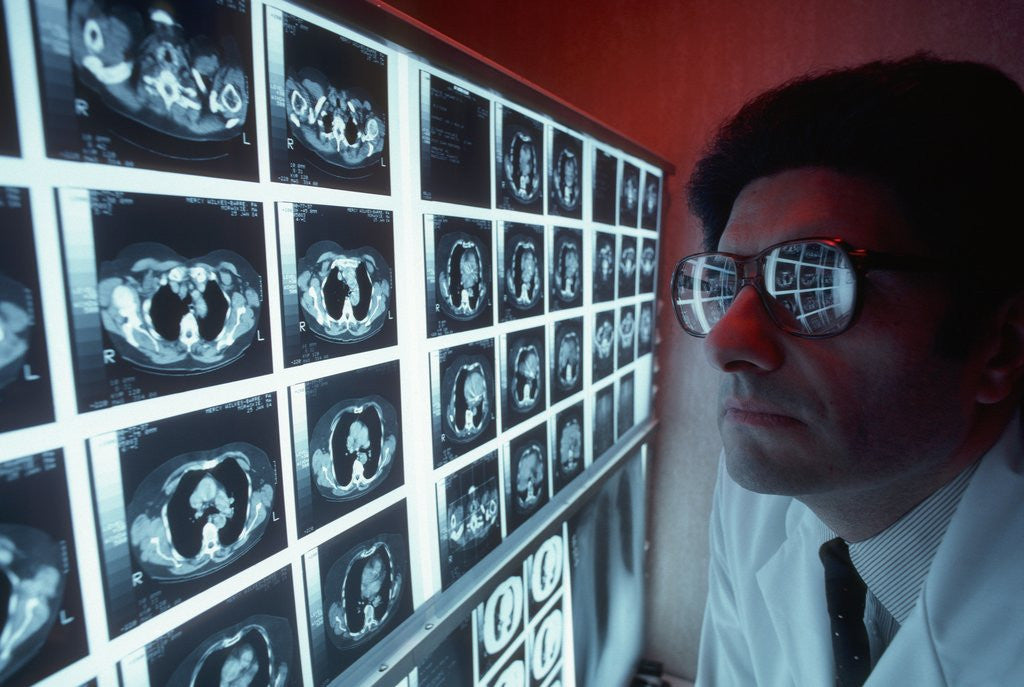 Detail of 1980s doctor examining CAT scan by Anonymous