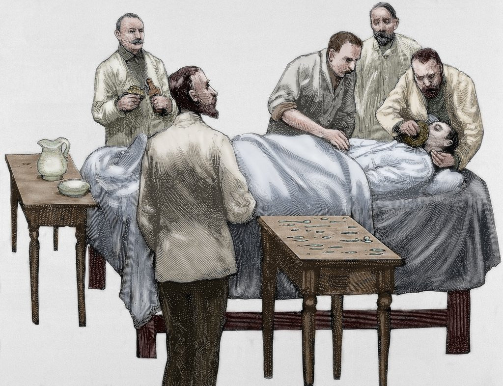 Detail of History of medicine. Chloroform anesthesia. Engraving, 19th century. Colored. by Corbis